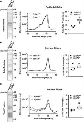 Methodologies to unlock the molecular expression and cellular structure of ocular lens epithelial cells